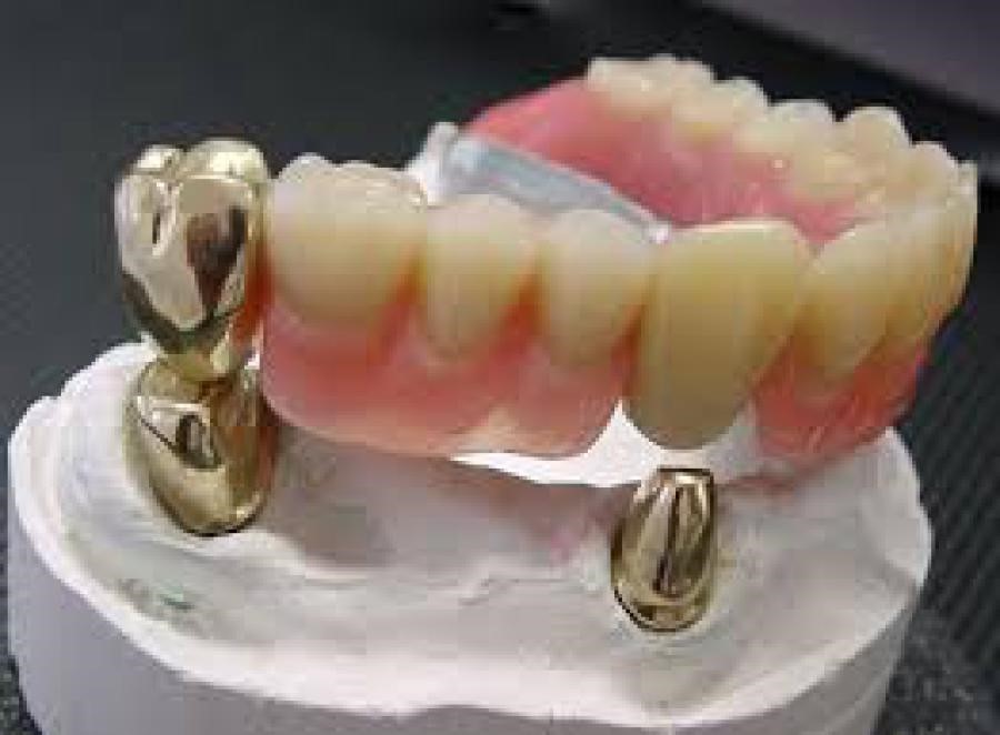 Jacket Dentures White Earth ND 58794